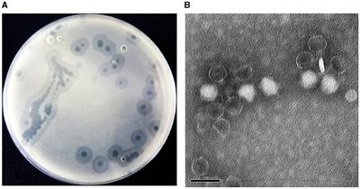 Isolation, characterization and therapeutic evaluation of a new Acinetobacter virus Abgy202141 lysing Acinetobacter baumannii